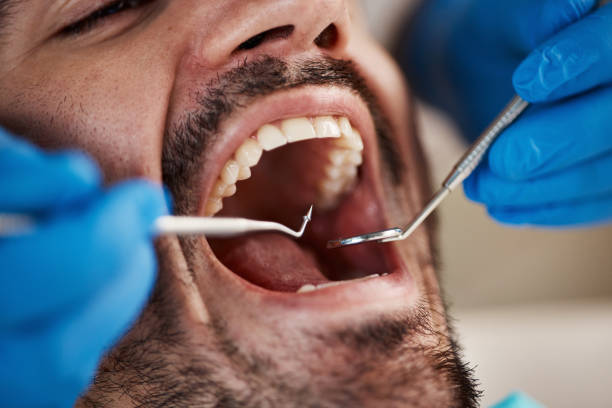 Best Walk-In Emergency Dentist in Wood River, IL
