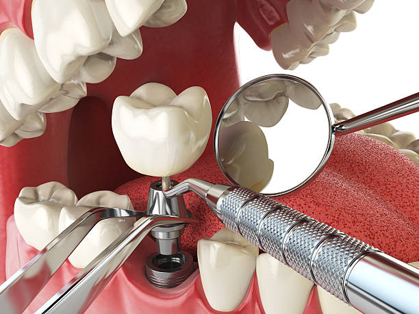 Best Emergency Broken Tooth Repair in Wood River, IL