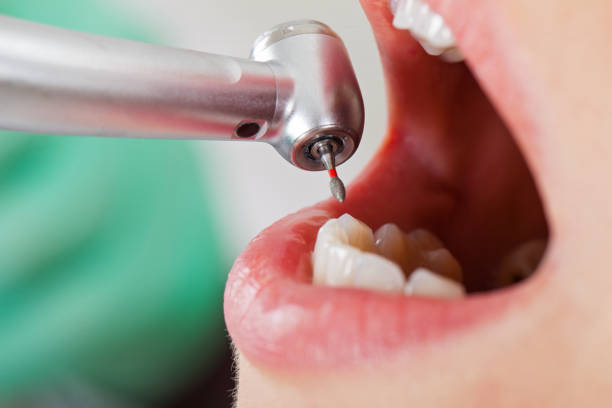 Best Emergency Treatment for Toothache in Wood River, IL